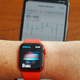 Illustration for article titled Rumor Has It the Next Samsung, Apple Smartwatches Might Monitor Blood Glucose